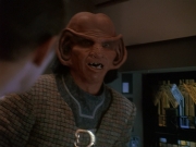 Filename=extant_StarTrek_DS9_4x10-OurManBashir_03543.jpg
Filesize=165KiB
Dimensions=1200x900
Date added=Oct 20, 2019 extant_StarTrek_DS9_4x10-OurManBashir_03543.jpg