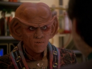 Filename=extant_StarTrek_DS9_7x07-OnceMoreUntoTheBreach_2532.jpg
Filesize=149KiB
Dimensions=1200x900
Date added=Jan 21, 2020 extant_StarTrek_DS9_7x07-OnceMoreUntoTheBreach_2532.jpg