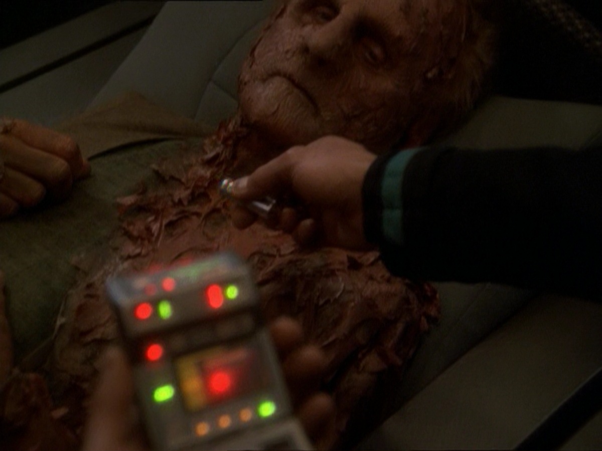 extant_StarTrek_DS9_7x23-ExtremeMeasures_0026.jpg
