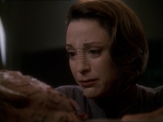 Filename=extant_StarTrek_DS9_7x23-ExtremeMeasures_0266.jpg
Filesize=131KiB
Dimensions=1200x900
Date added=Jan 22, 2020 extant_StarTrek_DS9_7x23-ExtremeMeasures_0266.jpg